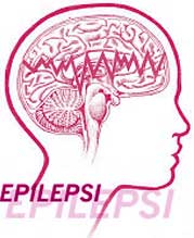 epilepsi