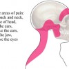 Sakit Kepala Tegang (Tension Headache)