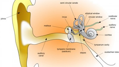 Tinnitus