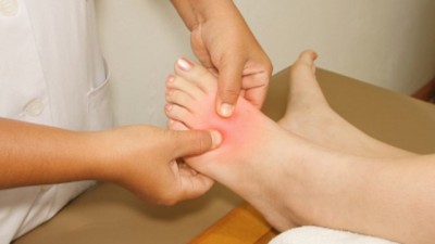 Plantar Fasciitis