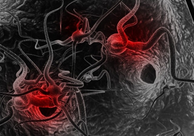 Amyotrophic Lateral Sclerosis (ALS)